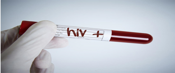 HIV breakthrough-Scientists remove virus in animals using gene editing